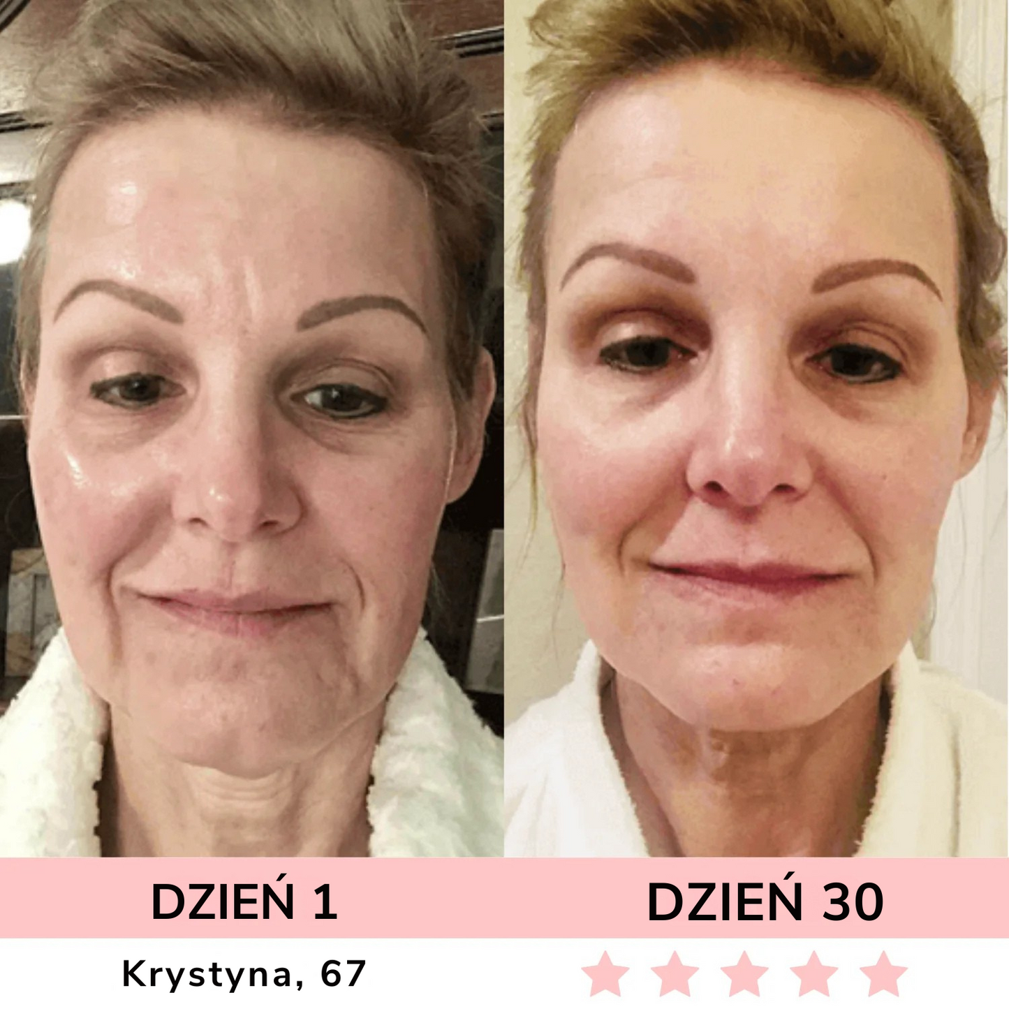 GLOW LANE – Urządzenie do pielęgnacji twarzy LED 7w1