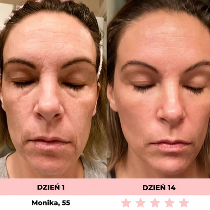 GLOW LANE – Urządzenie do pielęgnacji twarzy LED 7w1