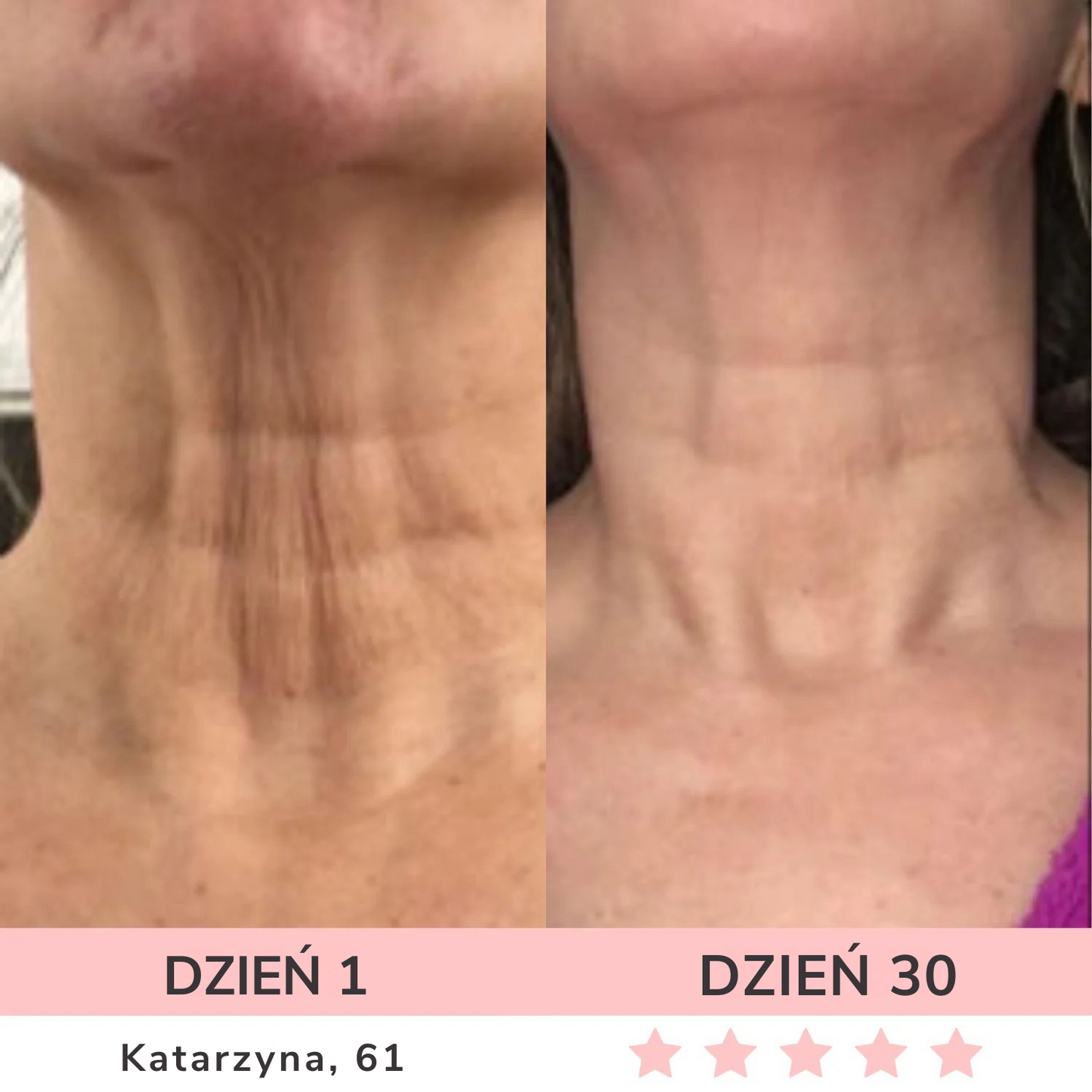 GLOW LANE – Urządzenie do pielęgnacji twarzy LED 7w1