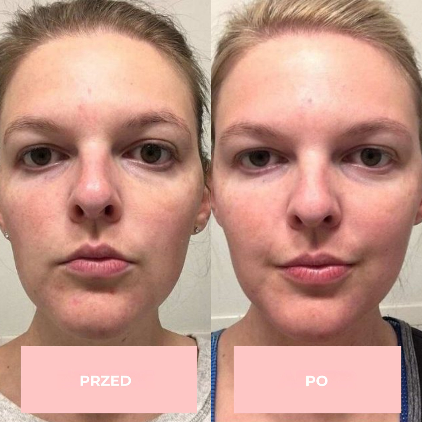 Maska na twarz GlowLane LED 7-w-1