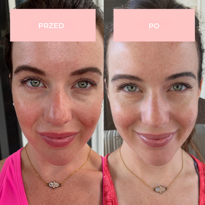 Maska na twarz GlowLane LED 7-w-1