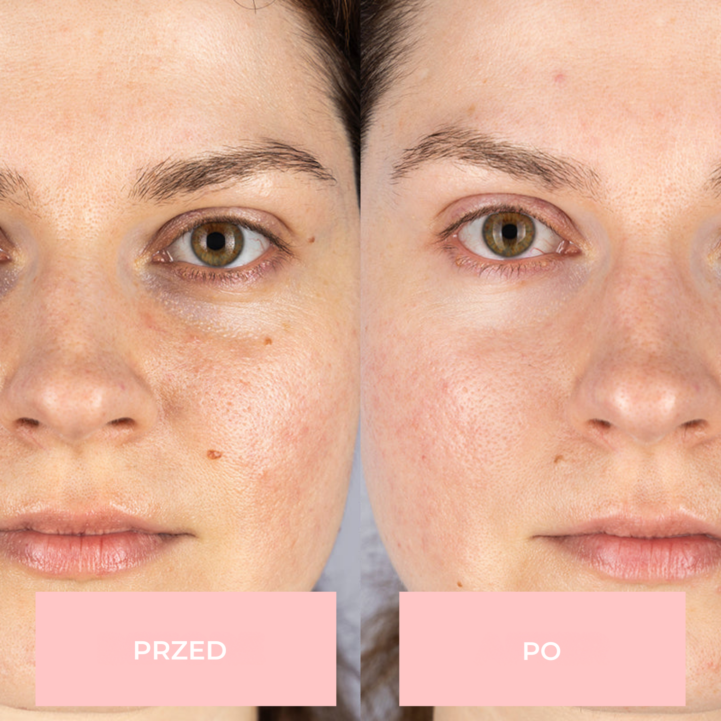 Maska na twarz GlowLane LED 7-w-1